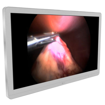 LG Digital Signage Display